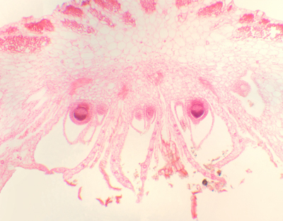 Marchantia archegonium, l.s.