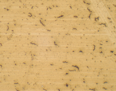 Three types of bacteria smear