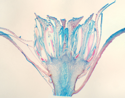Moss antheridium, l.s.