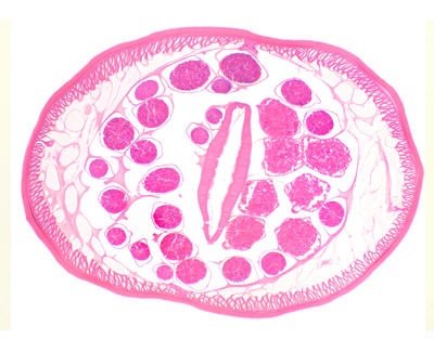 Ascaris male, c.s.