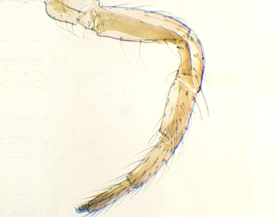 Insect walking leg, w.m.