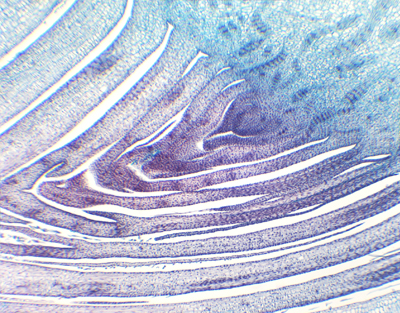 Sugarcane armpit bud, c.s.