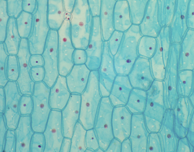 Onion stomata, w.m.