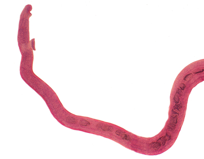 Hembra de Schistosoma, m.e.