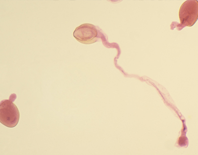 Pollen germe, s.e.