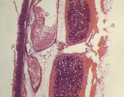 Trachea, l.s.
