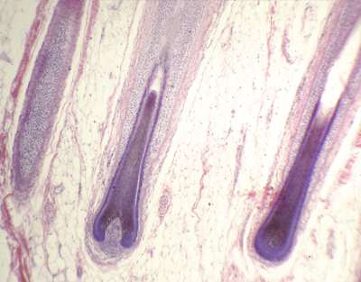 Mammal skin, hair follicles, sec.