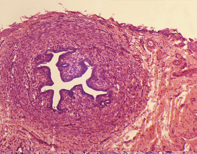 Fallopian tube, c.s.