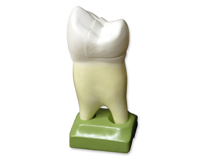 Upper premolar, 2 roots