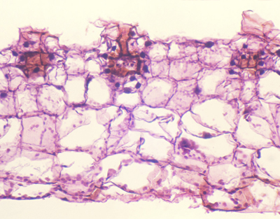 Fern prothallus w/archegonium, c.s.
