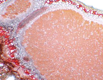Nodule de racine de Glycine max, c.t.