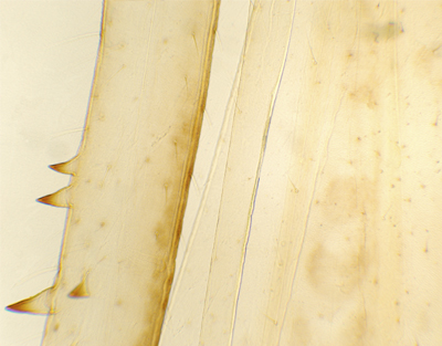 Patte d'insect sauteur, s.e.