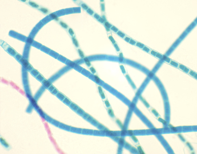 Blue-green alga, w.m.