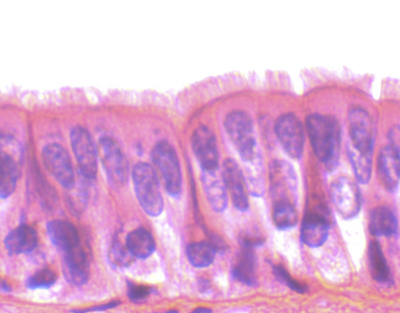 Epitelio ciliado, sec.