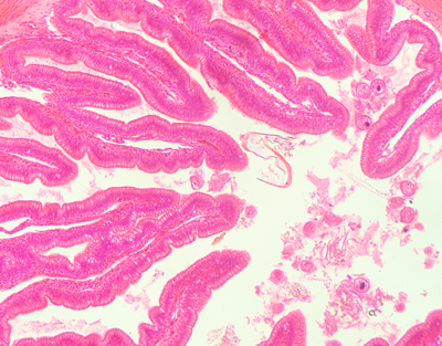 Intestino grueso de rana, s.t.