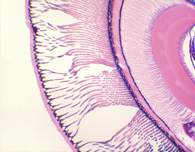 Insect compund eye, sec.