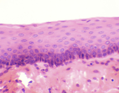 Epitelio estratificado plano, sec.