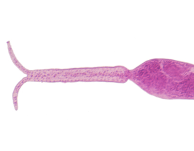 Cercaria de Schistosoma, m.e.